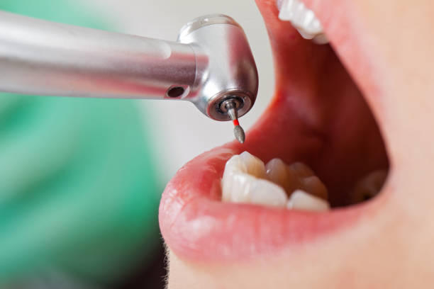 Fast & Reliable Emergency Dental Services in OR